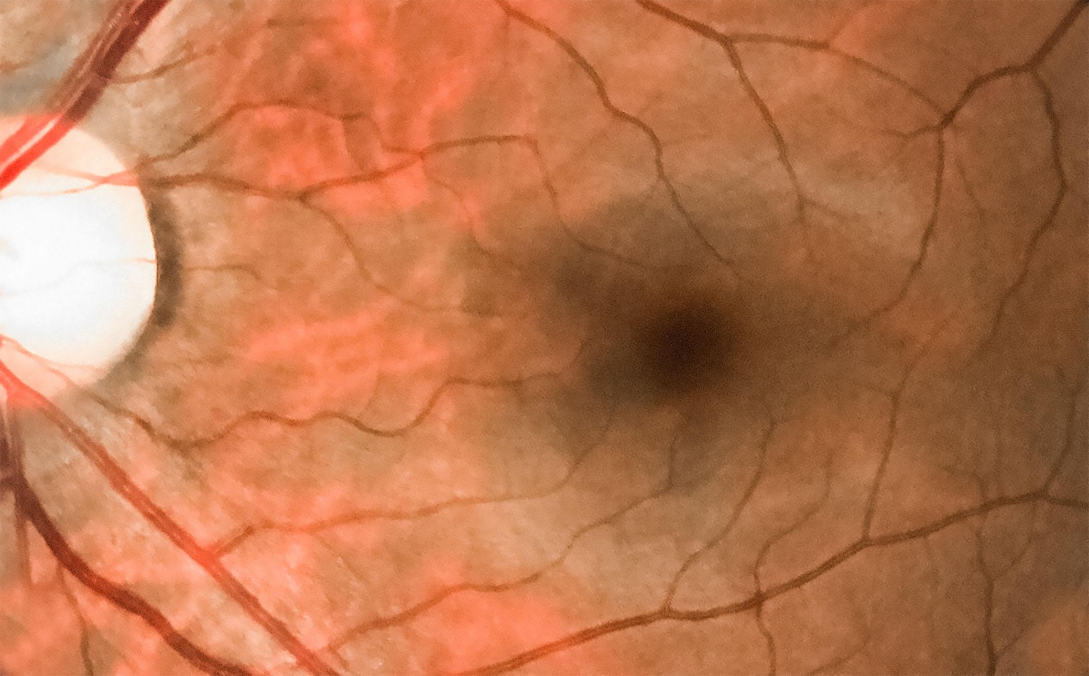 retina